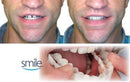 Fitflex Denture