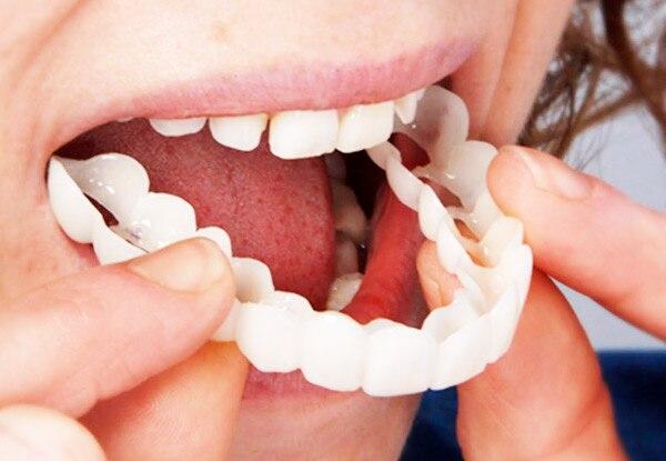 Fitflex Denture