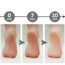 Lime À Pieds Professionnelle Pour Enlever Les Callosités